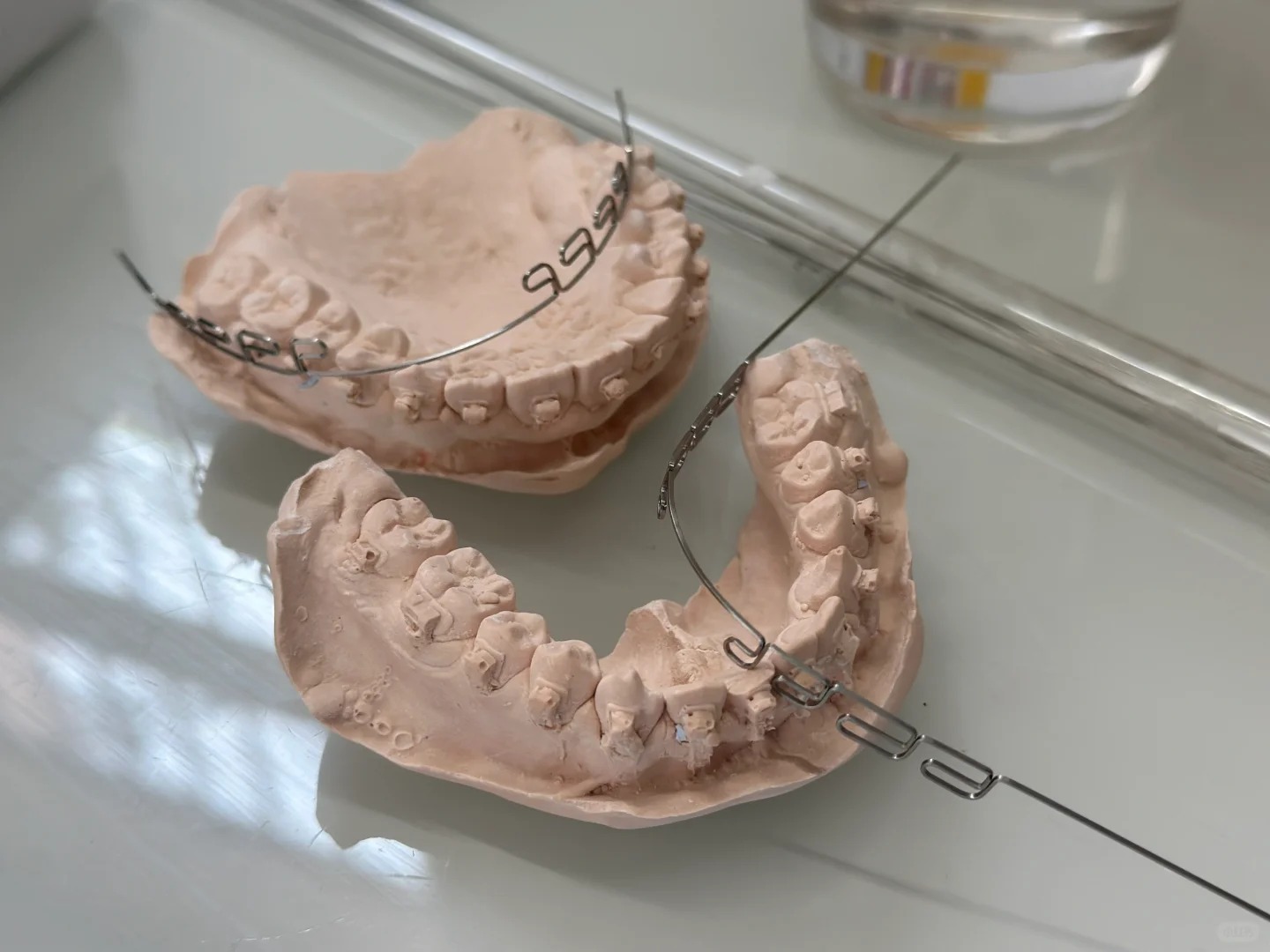 Chỉnh nha kiểu Meaw - Geaw: Vì sao được giới trẻ săn đón? - Ảnh 2. Chỉnh nha kiểu Meaw - Geaw: Vì sao được giới trẻ săn đón? - Ảnh 2.