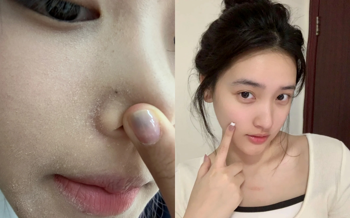 5 serum cấp ẩm cho &quot;da ngậm nước&quot; dù ngồi điều hòa cả ngày - Ảnh 1.