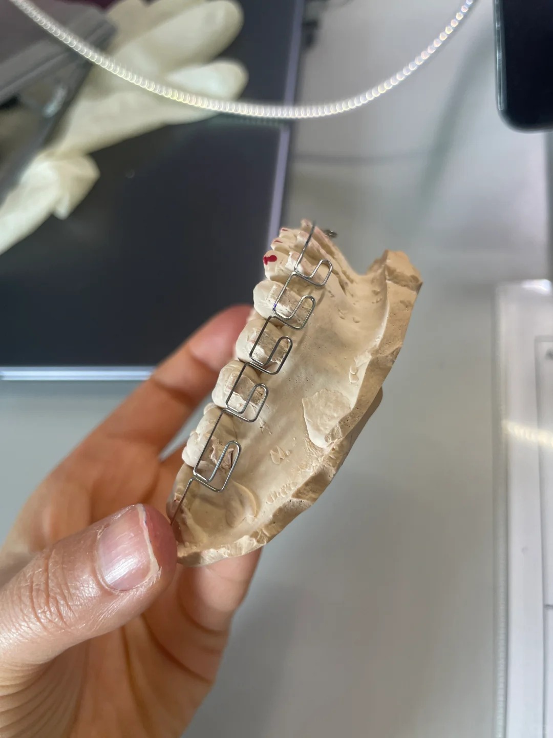 Chỉnh nha kiểu Meaw - Geaw: Vì sao được giới trẻ săn đón? - Ảnh 3. Chỉnh nha kiểu Meaw - Geaw: Vì sao được giới trẻ săn đón? - Ảnh 3.