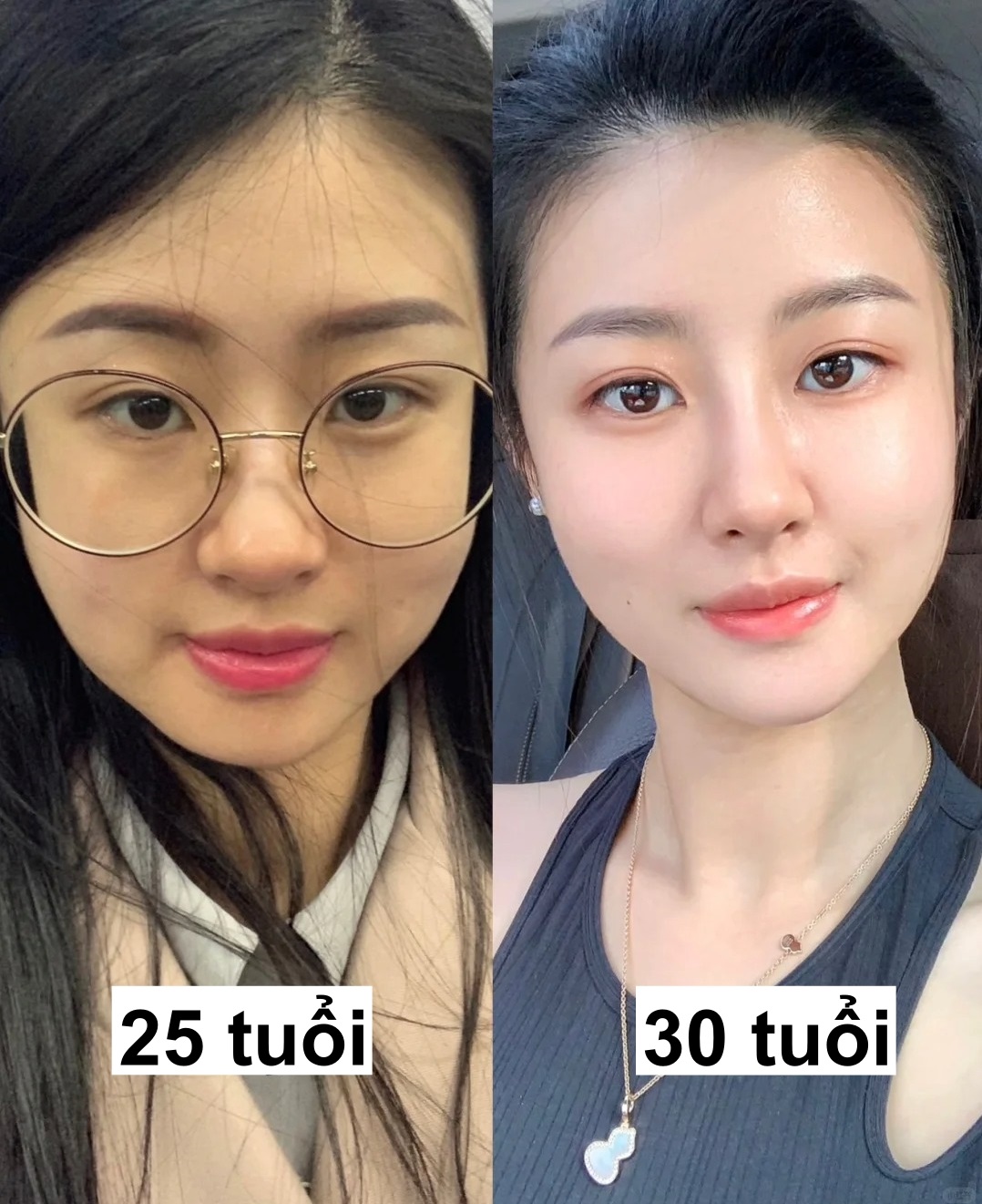 Cách "trẻ hóa da" của cô gái Trung: Càng lớn tuổi da càng đẹp khó tin - Ảnh 1. Cách "trẻ hóa da" của cô gái Trung: Càng lớn tuổi da càng đẹp khó tin - Ảnh 1.