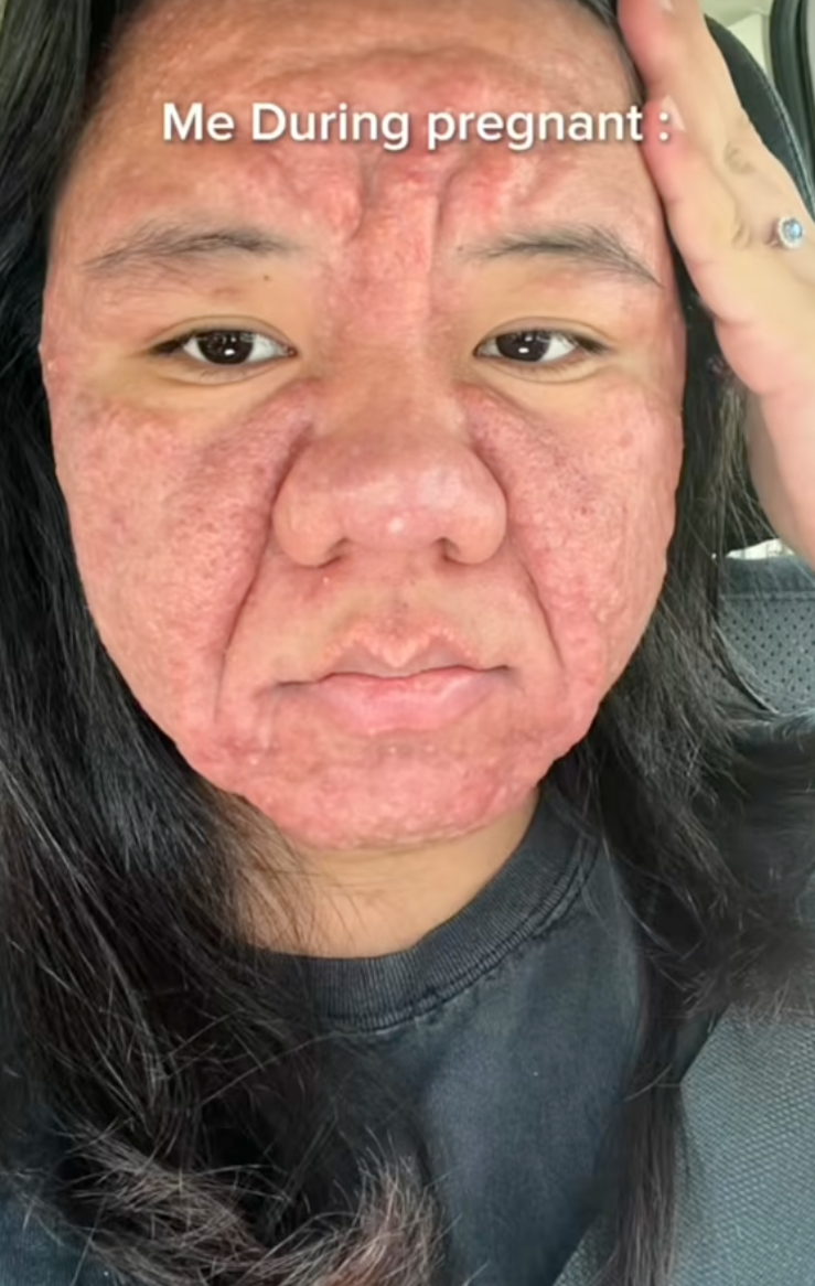 Mẹ bỉm 28 tuổi chia sẻ hình ảnh mang thai với gương mặt biến đổi hoàn toàn khiến cả cõi mạng dậy sóng- Ảnh 3. Mẹ bỉm 28 tuổi chia sẻ hình ảnh mang thai với gương mặt biến đổi hoàn toàn khiến cả cõi mạng dậy sóng- Ảnh 3.