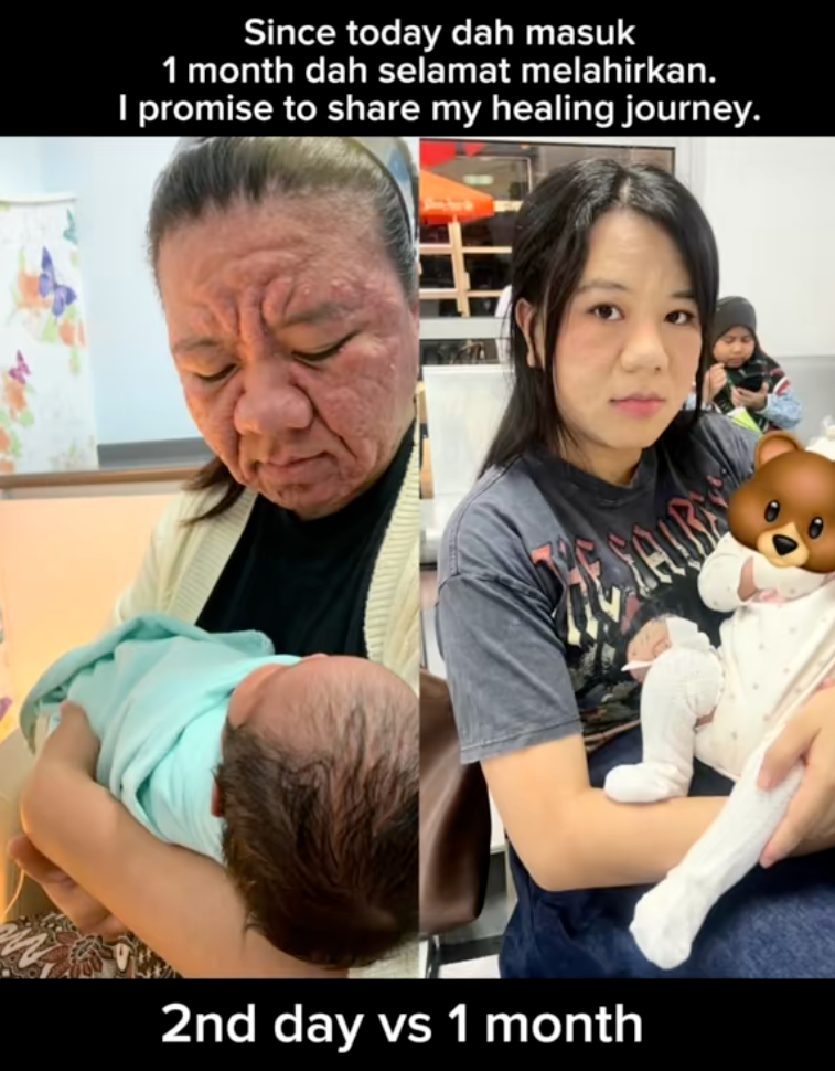 Mẹ bỉm 28 tuổi chia sẻ hình ảnh mang thai với gương mặt biến đổi hoàn toàn khiến cả cõi mạng dậy sóng- Ảnh 7. Mẹ bỉm 28 tuổi chia sẻ hình ảnh mang thai với gương mặt biến đổi hoàn toàn khiến cả cõi mạng dậy sóng- Ảnh 7.