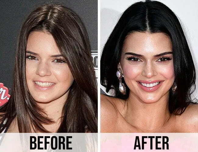 17-kendall-icerikjpg-1754477181985954184962-1754534011967-17545340120691097366820.jpg