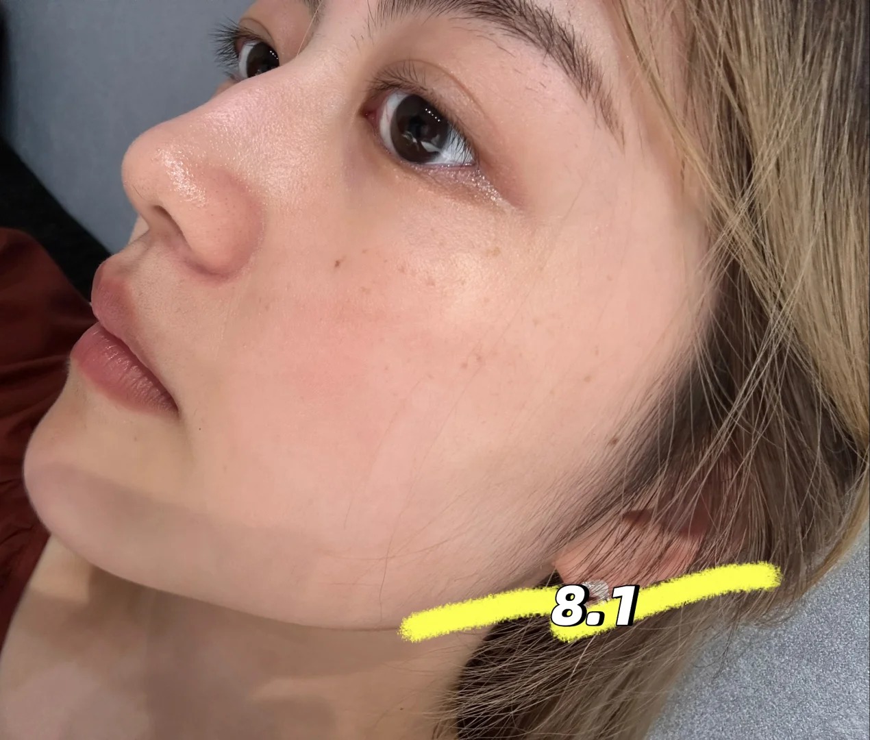Lỗ chân lông nhỏ đi thấy rõ sau 1 tháng cô nàng này dùng bộ đôi serum dưỡng da bình dân của Hàn - Ảnh 3.
