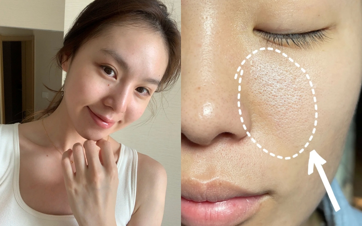 Lỗ chân lông nhỏ đi thấy rõ sau 1 tháng cô nàng này dùng bộ đôi serum dưỡng da bình dân của Hàn - Ảnh 1.