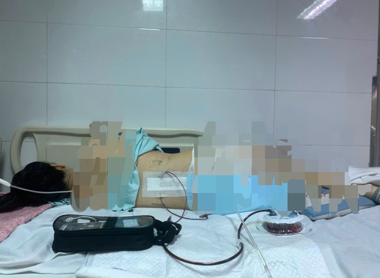 Khởi tố vụ cô gái mất 96% sức khỏe vì bị khung đỡ đèn tiệc cưới đổ sập, đè lên người - Ảnh 1. Khởi tố vụ cô gái mất 96% sức khỏe vì bị khung đỡ đèn tiệc cưới đổ sập, đè lên người - Ảnh 1.