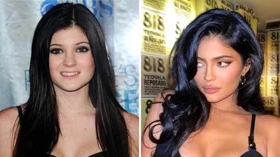 kylie-jenner-plastic-surgery-17544768889211688310756-1754534006633-1754534006711144430244.jpg