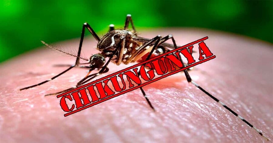 Virus Chikungunya 
