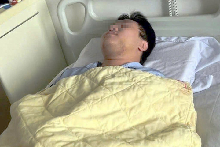 Chỉ vì 'ánh mắt', nam sinh Hà Nội bị đánh gãy xương hàm giữa ban ngày - Ảnh 2.