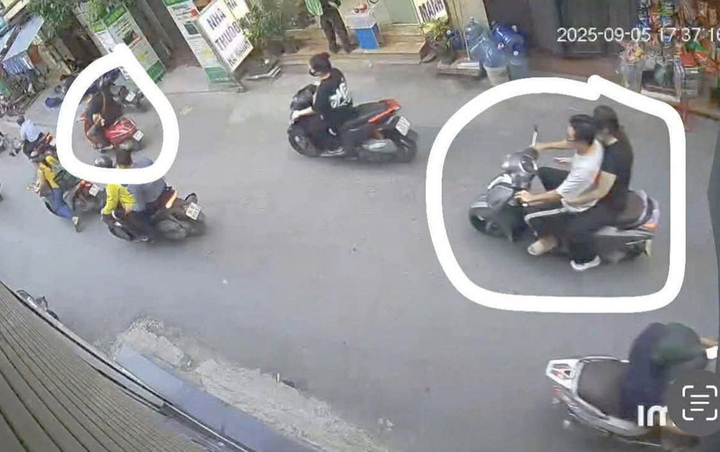 Chỉ vì 'ánh mắt', nam sinh Hà Nội bị đánh gãy xương hàm giữa ban ngày - Ảnh 1.