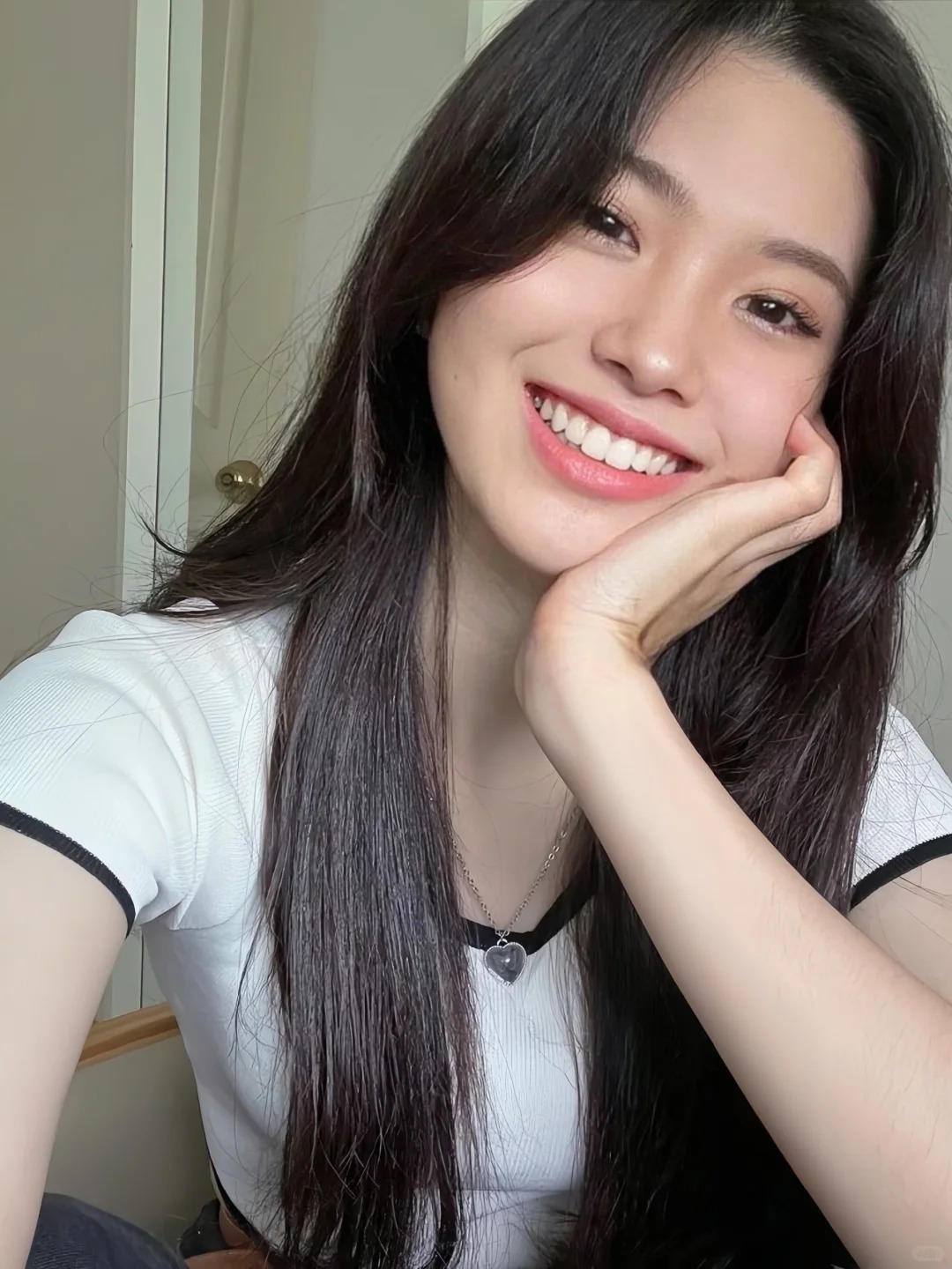 Đừng để răng sứ &quot;làm hỏng nụ cười&quot; khi mắc phải những sai lầm cơ bản này - Ảnh 7.