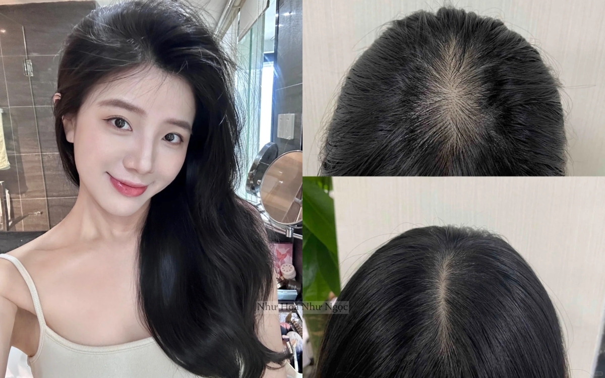 Từ mái tóc rụng không kiểm soát, cô nàng này đã &quot;hồi sinh&quot; tóc chỉ bằng thói quen đơn giản - Ảnh 1.