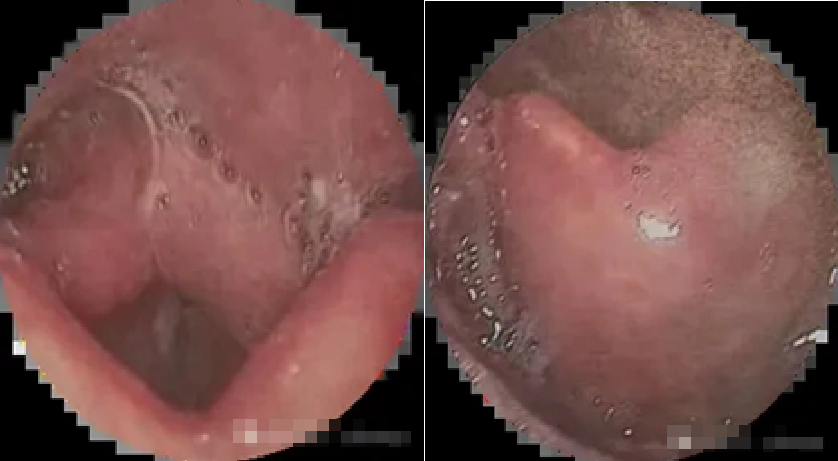 Chụp ảnh ở b&atilde;i cỏ, c&ocirc; g&aacute;i su&yacute;t chết ngạt- Ảnh 2.