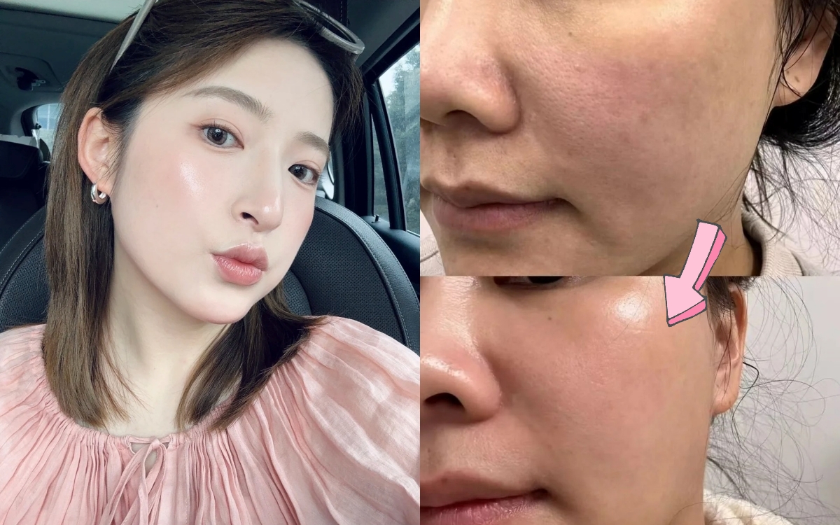 5 lọ serum tăng cường collagen rất cần cho phụ nữ ngoài 30 tuổi - Ảnh 1.