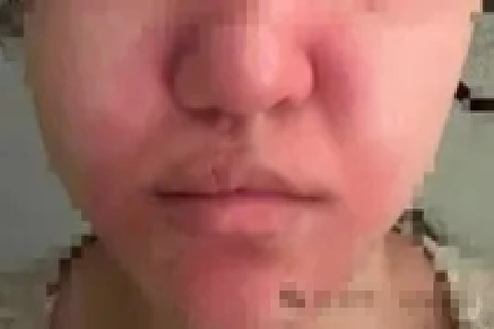 Chụp ảnh ở b&atilde;i cỏ, c&ocirc; g&aacute;i su&yacute;t chết ngạt- Ảnh 1.