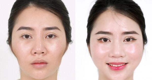 Huyền Lizzie đam mê 1 kiểu làm đẹp lấp đầy má hóp, thái dương lõm, "cá sấu chúa" Quỳnh Nga cũng kết thân để nhan sắc ngọt ngào, e ấp như thiếu nữ đôi mươi - Ảnh 6. Huyền Lizzie đam mê 1 kiểu làm đẹp lấp đầy má hóp, thái dương lõm, "cá sấu chúa" Quỳnh Nga cũng kết thân để nhan sắc ngọt ngào, e ấp như thiếu nữ đôi mươi - Ảnh 6.