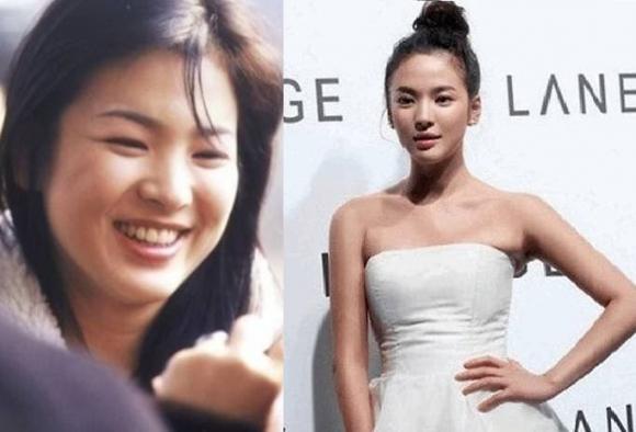 Song Hye Kyo giảm 17kg dễ dàng nhờ 1 món ăn màu trắng bổ xương khớp, 1 loại nước &quot;kem nhả nắng&quot; làm trắng da: Toàn loại quen thuộc, rẻ bèo ở chợ Việt - Ảnh 3.