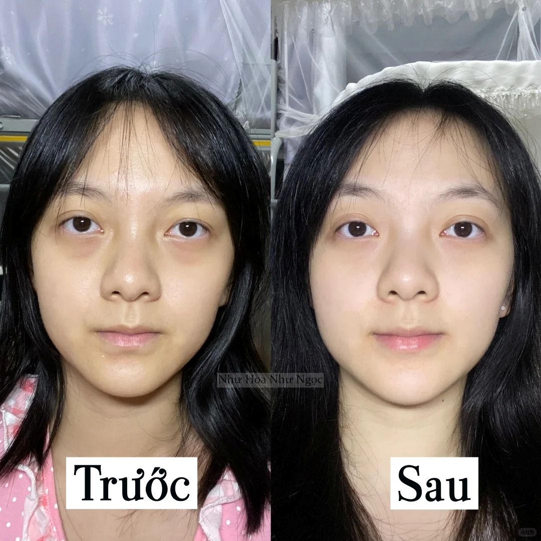 Cách dưỡng da &quot;không tốn một đồng&quot; nhưng cực hiệu quả của phụ nữ xứ Trung - Ảnh 4.