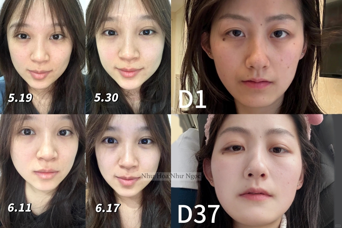 Cách dưỡng da &quot;không tốn một đồng&quot; nhưng cực hiệu quả của phụ nữ xứ Trung - Ảnh 5.