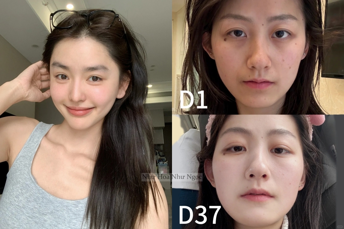 Cách dưỡng da &quot;không tốn một đồng&quot; nhưng cực hiệu quả của phụ nữ xứ Trung - Ảnh 1.