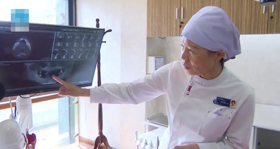 Người phụ nữ 44 tuổi rụng gần hết răng vì thói quen ai cũng dễ bỏ qua- Ảnh 1. Người phụ nữ 44 tuổi rụng gần hết răng vì thói quen ai cũng dễ bỏ qua- Ảnh 1.