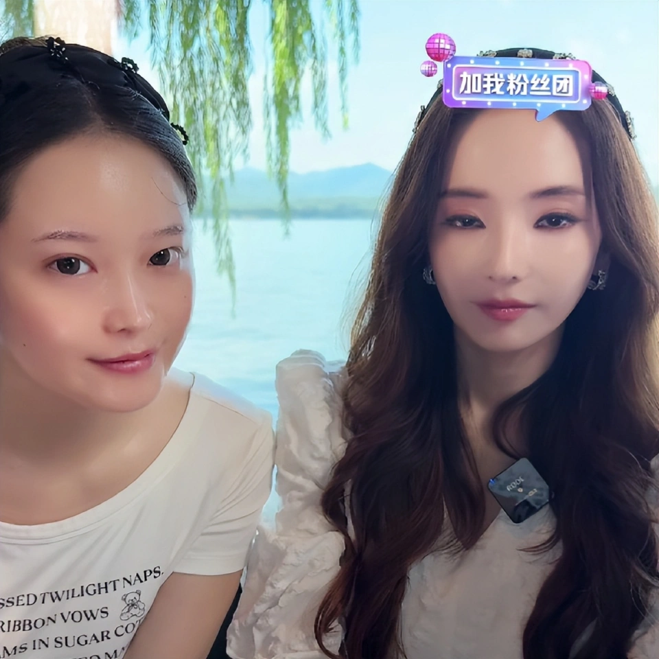 Mỹ nhân đẹp nhất Vườn Sao Băng làm sao thế này: Mặt mũi đơ như tượng, mắt lờ đờ, miệng cũng không mở nổi! - Ảnh 3. Mỹ nhân đẹp nhất Vườn Sao Băng làm sao thế này: Mặt mũi đơ như tượng, mắt lờ đờ, miệng cũng không mở nổi! - Ảnh 3.