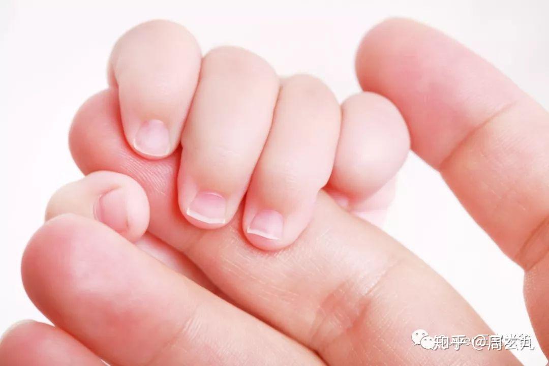 Thứ nhỏ xíu nhưng lại khiến nhiều mẹ sợ hãi: Làm sao để chăm sóc thứ bé tí nhưng lớn nhanh như thổi này?- Ảnh 1.
