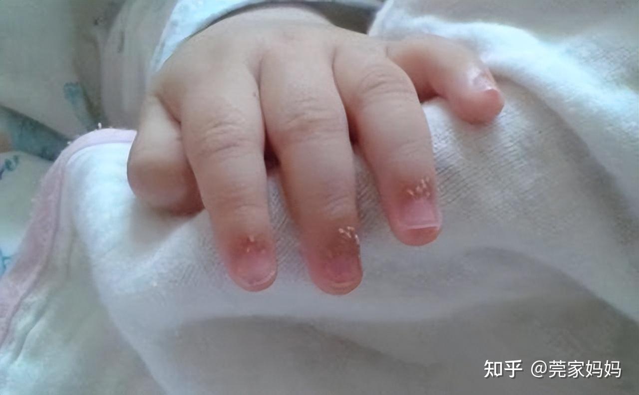 Thứ nhỏ xíu nhưng lại khiến nhiều mẹ sợ hãi: Làm sao để chăm sóc thứ bé tí nhưng lớn nhanh như thổi này?- Ảnh 3.
