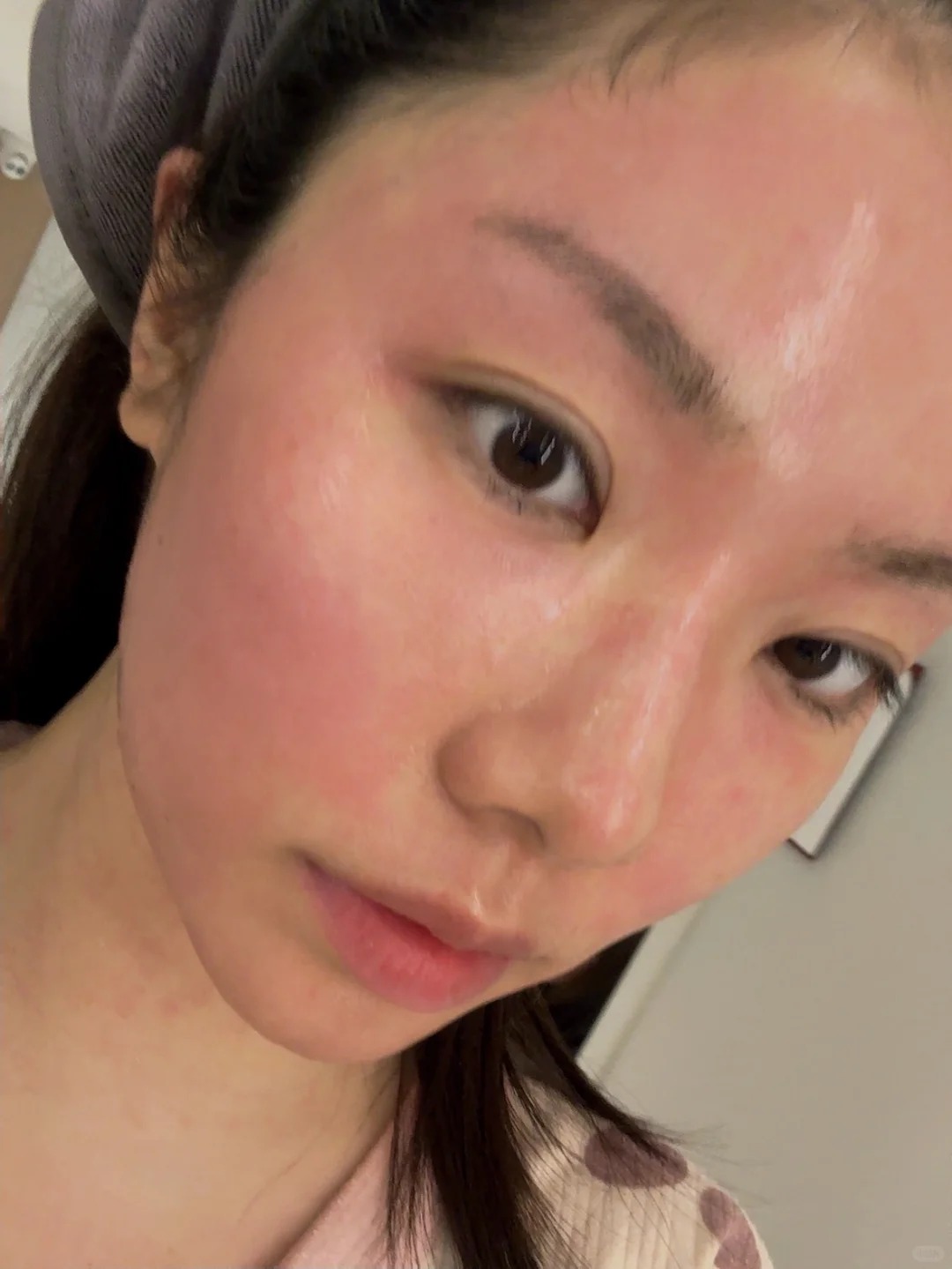Skincare tối giản dành cho người mới làm thẩm mỹ vùng mặt - Ảnh 2.
