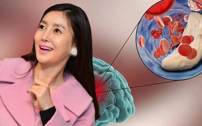 Nữ ca sĩ chia sẻ cơn ác mộng mang tên &quot;vỡ mạch máu não ở tuổi 34&quot;: Bắt đầu là những cơn đau đầu &quot;dữ dội như sét đánh&quot;