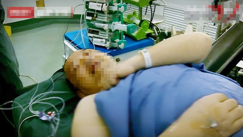 Mắc bệnh tim sau 1 năm chạy bộ mỗi sáng, nguyên nhân gây bất ngờ- Ảnh 1.