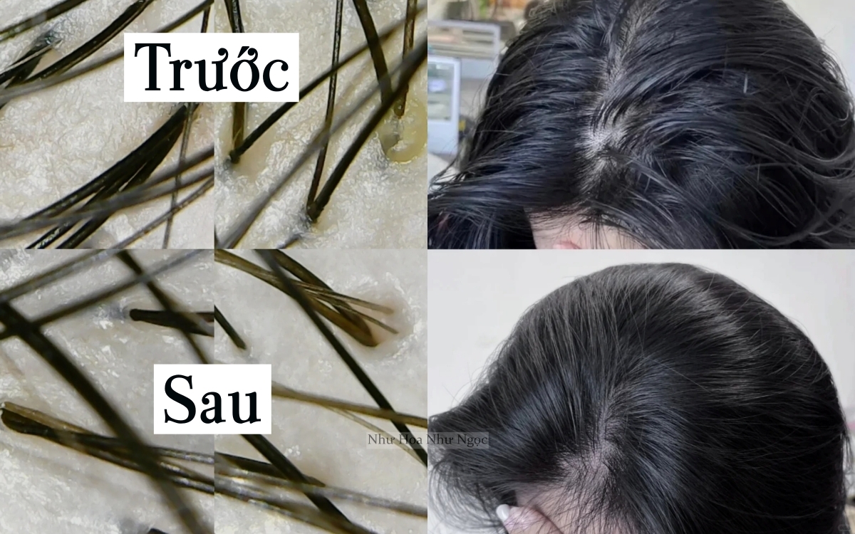 Dùng dầu tẩy trang để gội đầu, tôi đã nhận được kết quả ngoài mong đợi - Ảnh 4.