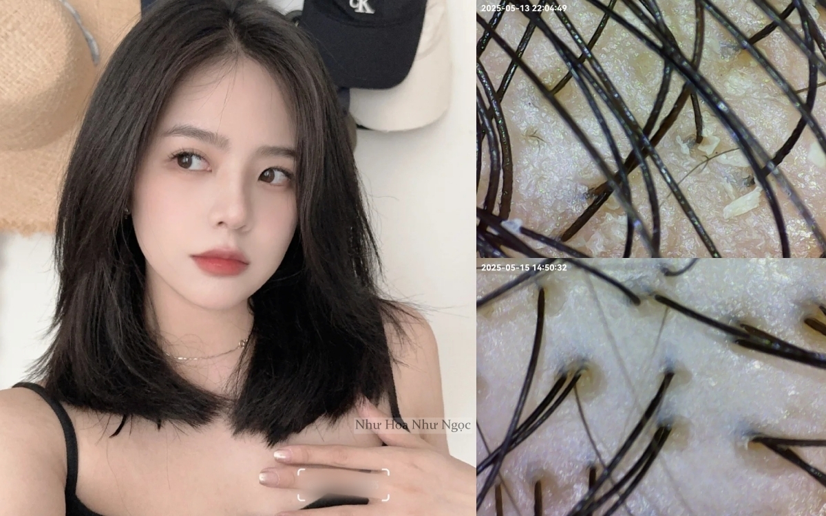 Dùng dầu tẩy trang để gội đầu, tôi đã nhận được kết quả ngoài mong đợi - Ảnh 2.