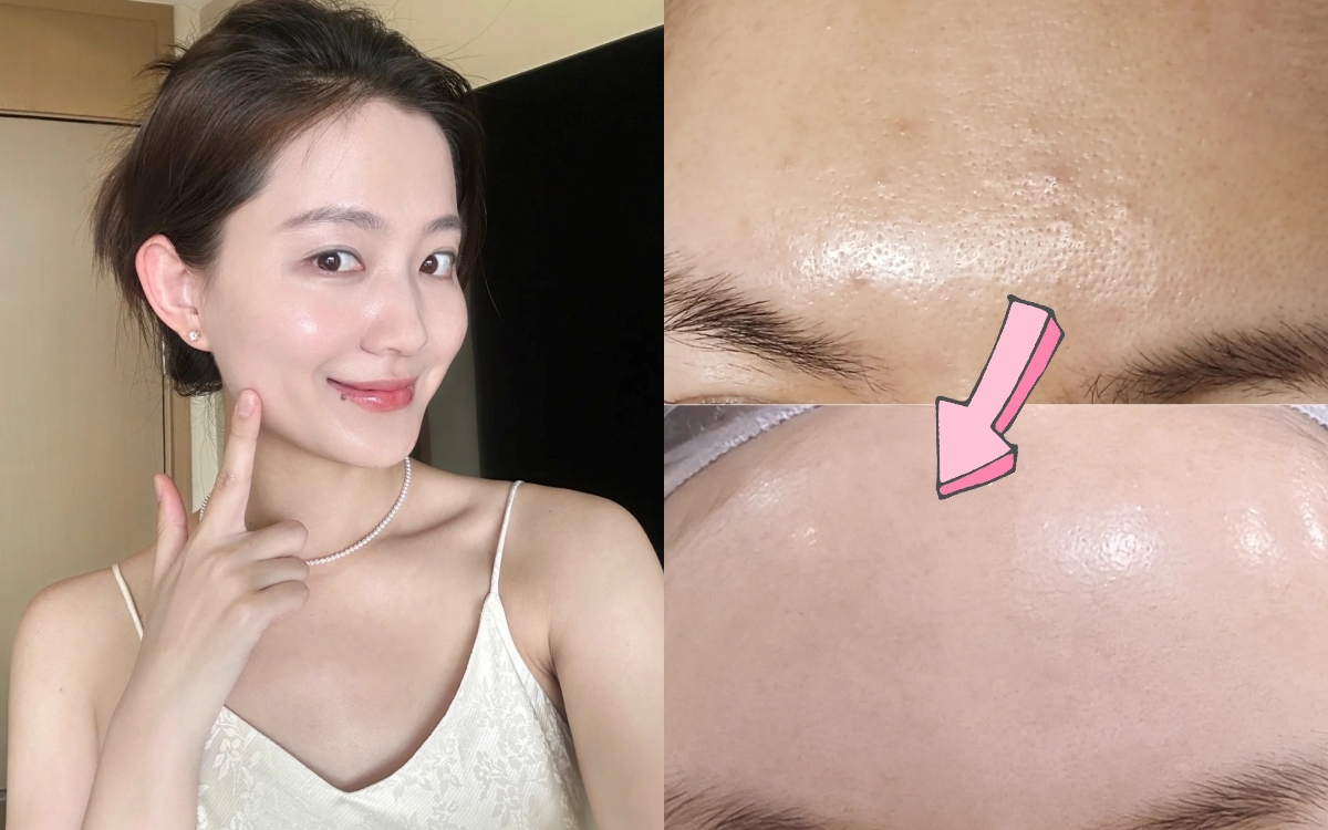 Nhỏ thêm 3 giọt serum này vào kem dưỡng cho da "ngậm nước" căng bóng tức thì - Ảnh 1. Nhỏ thêm 3 giọt serum này vào kem dưỡng cho da "ngậm nước" căng bóng tức thì - Ảnh 1.