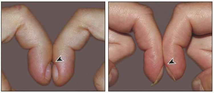 Bác sĩ đi mua nhà, nhìn thấy tay nhân viên môi giới liền bảo cô đi khám ngay, kết quả là ung thư phổi: Dấu hiệu nào mà "nhìn một cái thấy ngay"- Ảnh 4. Bác sĩ đi mua nhà, nhìn thấy tay nhân viên môi giới liền bảo cô đi khám ngay, kết quả là ung thư phổi: Dấu hiệu nào mà "nhìn một cái thấy ngay"- Ảnh 4.