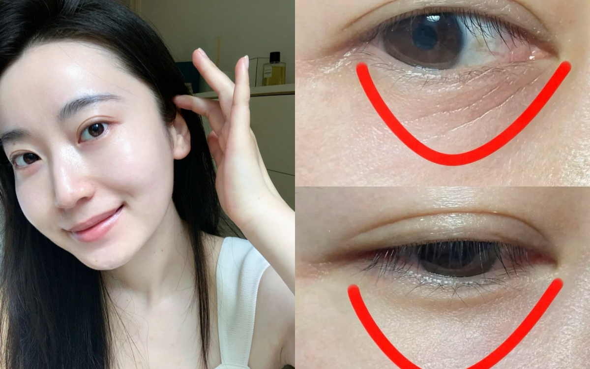 5 lọ serum retinol dành cho người mới: Êm ái, nhẹ nhàng mà vẫn "hack tuổi" đỉnh cao - Ảnh 1. 5 lọ serum retinol dành cho người mới: Êm ái, nhẹ nhàng mà vẫn "hack tuổi" đỉnh cao - Ảnh 1.