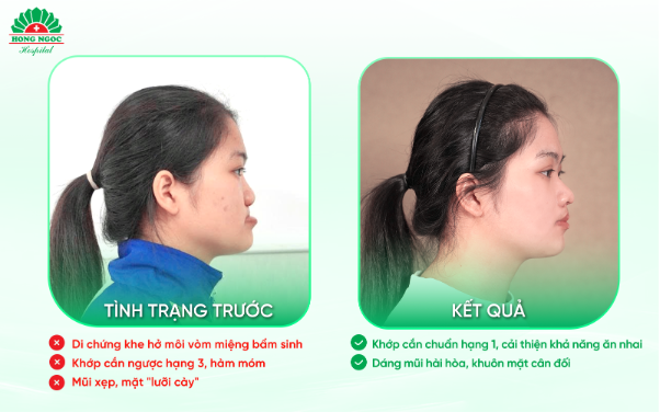 Chắp cánh ước mơ - Thắp sáng hy vọng cho bệnh nhân dị tật/biến dạng hàm mặt - Ảnh 6. Chắp cánh ước mơ - Thắp sáng hy vọng cho bệnh nhân dị tật/biến dạng hàm mặt - Ảnh 6.
