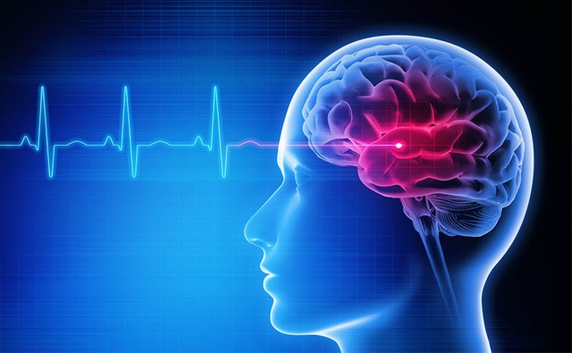 stroke3-1757085977240521875512-1757155400413-1757155400535360405881.jpg