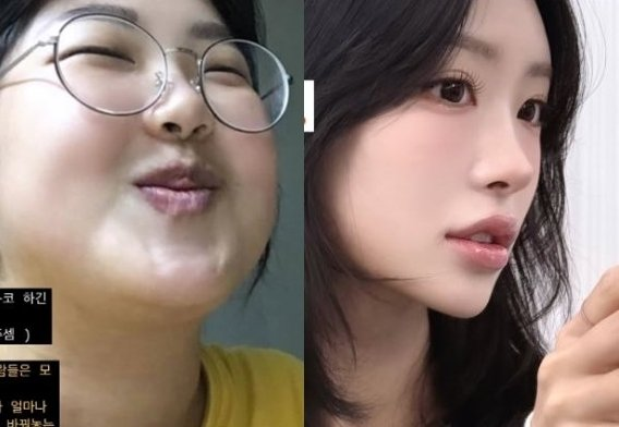 Con g&aacute;i của 1 nữ diễn vi&ecirc;n từng nặng gần 100kg, nay chỉ c&ograve;n da bọc xương- Ảnh 6.