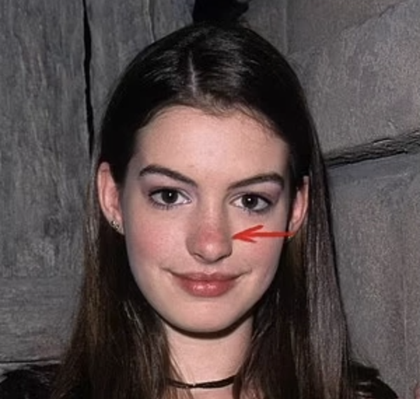 Quảng c&aacute;o sản phẩm chống l&atilde;o ho&aacute; của Anne Hathaway g&acirc;y tranh c&atilde;i - Ảnh 13.