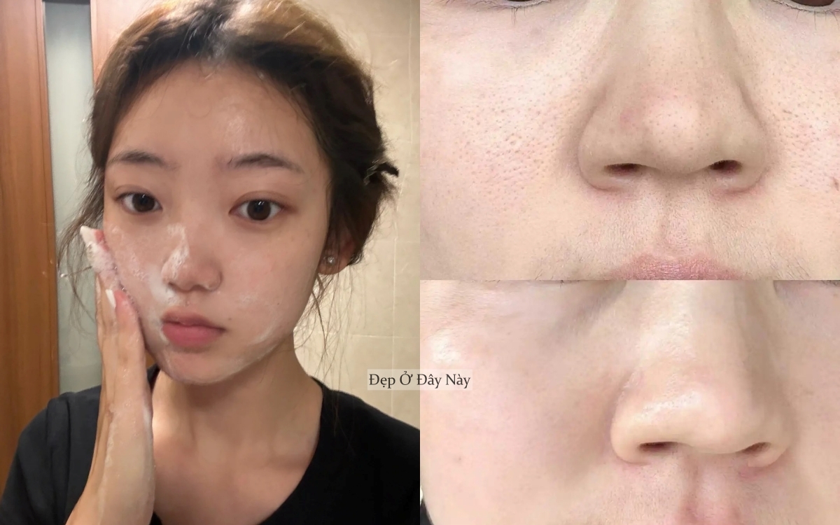 Thu nhỏ lỗ ch&acirc;n l&ocirc;ng với 5 loại sữa rửa mặt l&agrave;m sạch s&acirc;u m&agrave; kh&ocirc;ng g&acirc;y kh&ocirc; da - Ảnh 1.