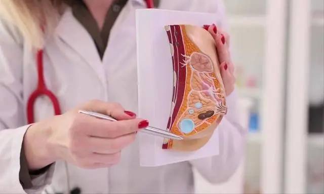 Phụ nữ sống thọ hay kh&ocirc;ng, nh&igrave;n v&agrave;o v&ograve;ng một l&agrave; thấy: 3 dấu hiệu ở ngực nhiều chị em xem nhẹ nhưng lại l&agrave; &ldquo;đ&egrave;n đỏ&rdquo; sức khỏe - Ảnh 3.