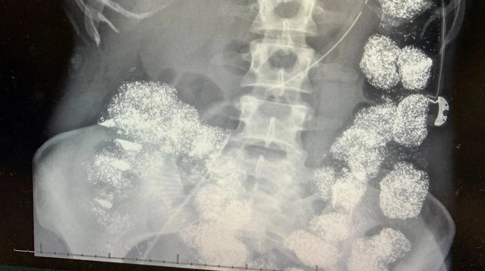 Vụ đầu độc bằng ch&igrave; trong gia đ&igrave;nh b&aacute;c sĩ g&acirc;y r&uacute;ng động dư luận - Ảnh 2.