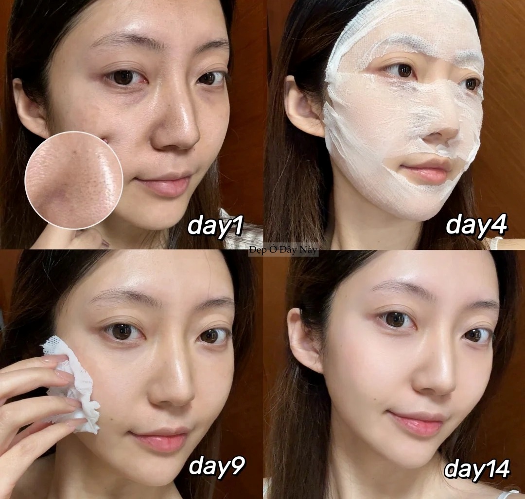 Kh&ocirc;ng cần spa tiền triệu, blogger 28 tuổi vẫn dưỡng trắng, mờ th&acirc;m n&aacute;m nhờ c&aacute;ch n&agrave;y - Ảnh 6.