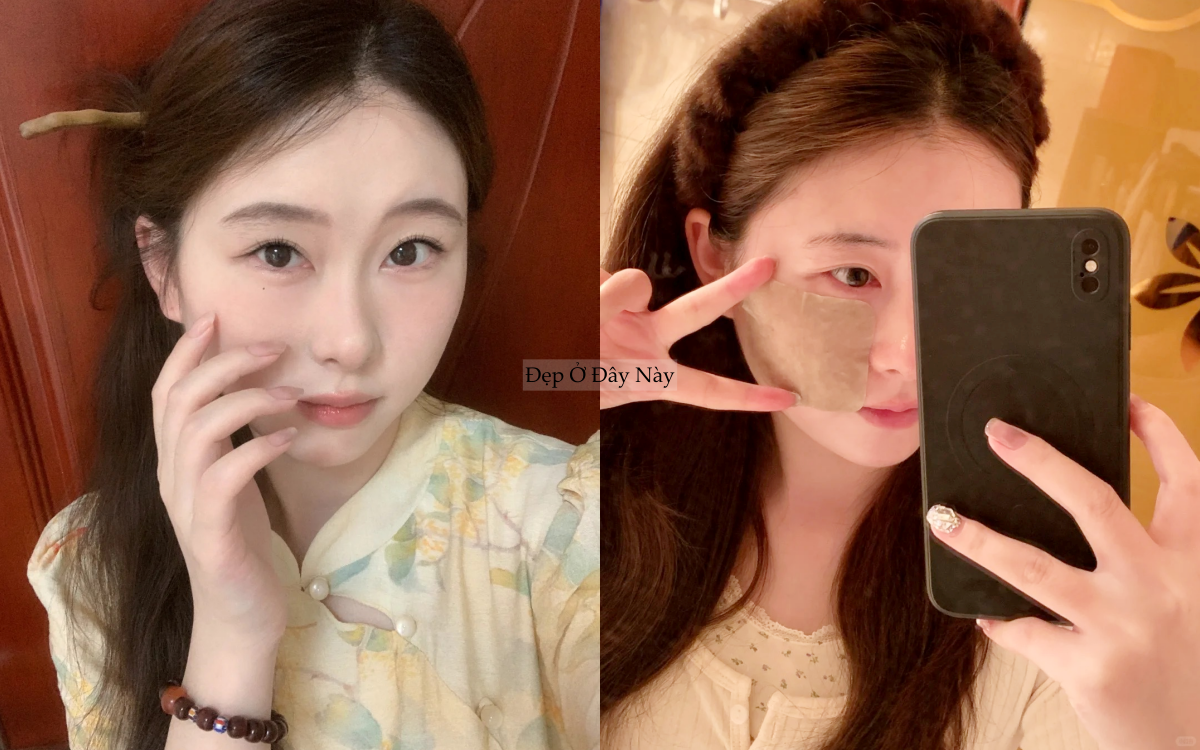 Nếp nhăn li ti của t&ocirc;i đ&atilde; biến mất ho&agrave;n to&agrave;n, chỉ nhờ chăm d&ugrave;ng thứ n&agrave;y mỗi tối - Ảnh 1.