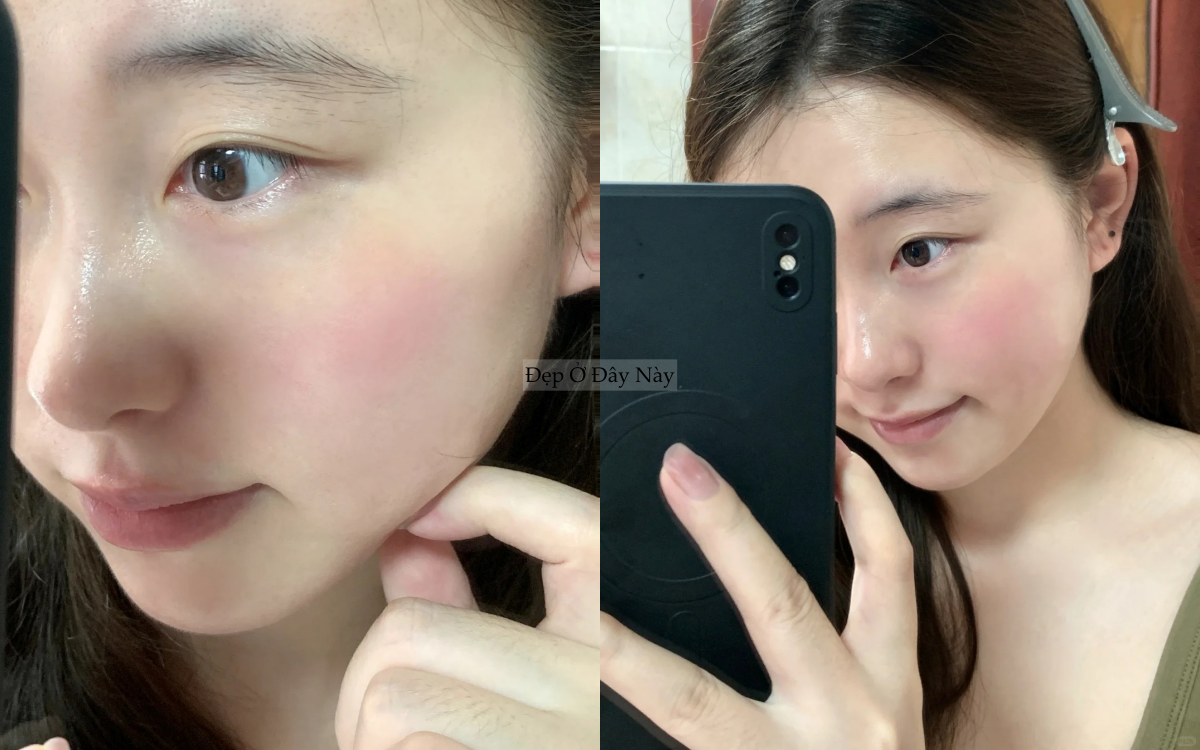 Nếp nhăn li ti của t&ocirc;i đ&atilde; biến mất ho&agrave;n to&agrave;n, chỉ nhờ chăm d&ugrave;ng thứ n&agrave;y mỗi tối - Ảnh 3.