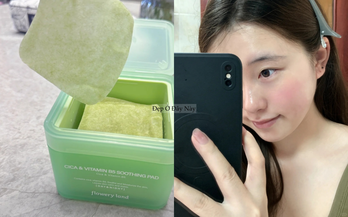 Nếp nhăn li ti của t&ocirc;i đ&atilde; biến mất ho&agrave;n to&agrave;n, chỉ nhờ chăm d&ugrave;ng thứ n&agrave;y mỗi tối - Ảnh 4.