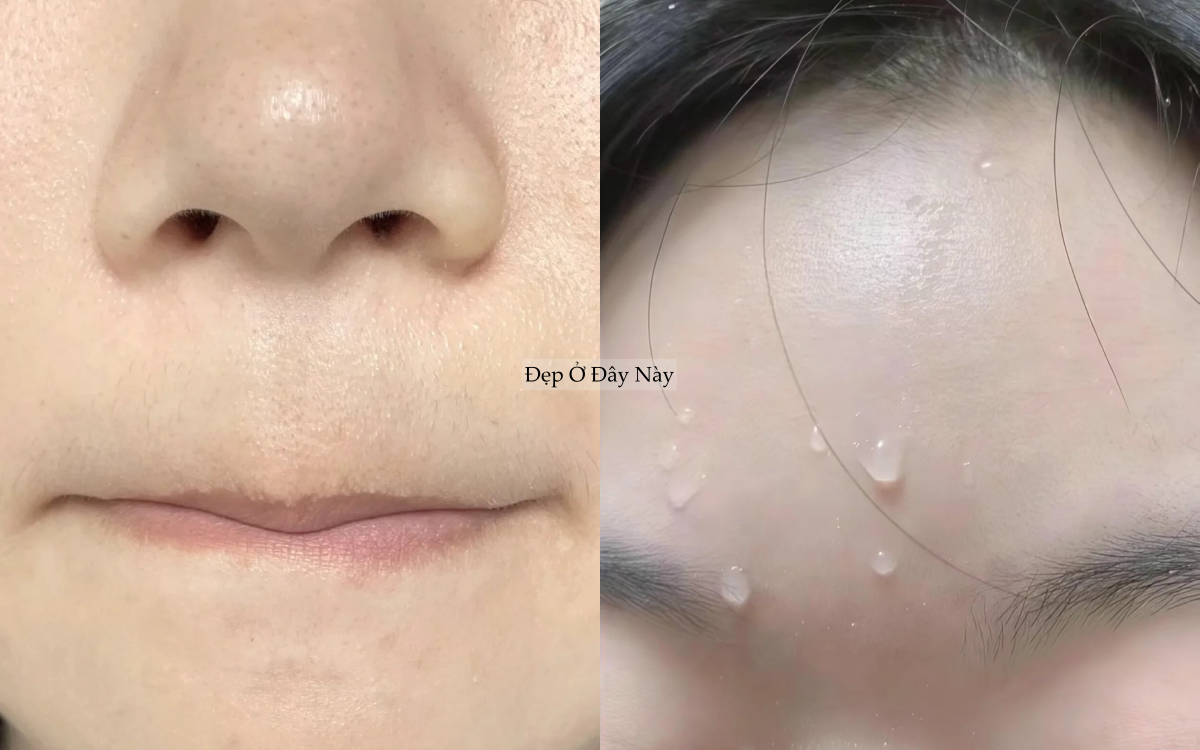 Kh&ocirc;ng d&ugrave;ng mỹ phẩm đắt tiền, blogger 25 tuổi vẫn thu nhỏ lỗ ch&acirc;n l&ocirc;ng thấy r&otilde; - Ảnh 3.