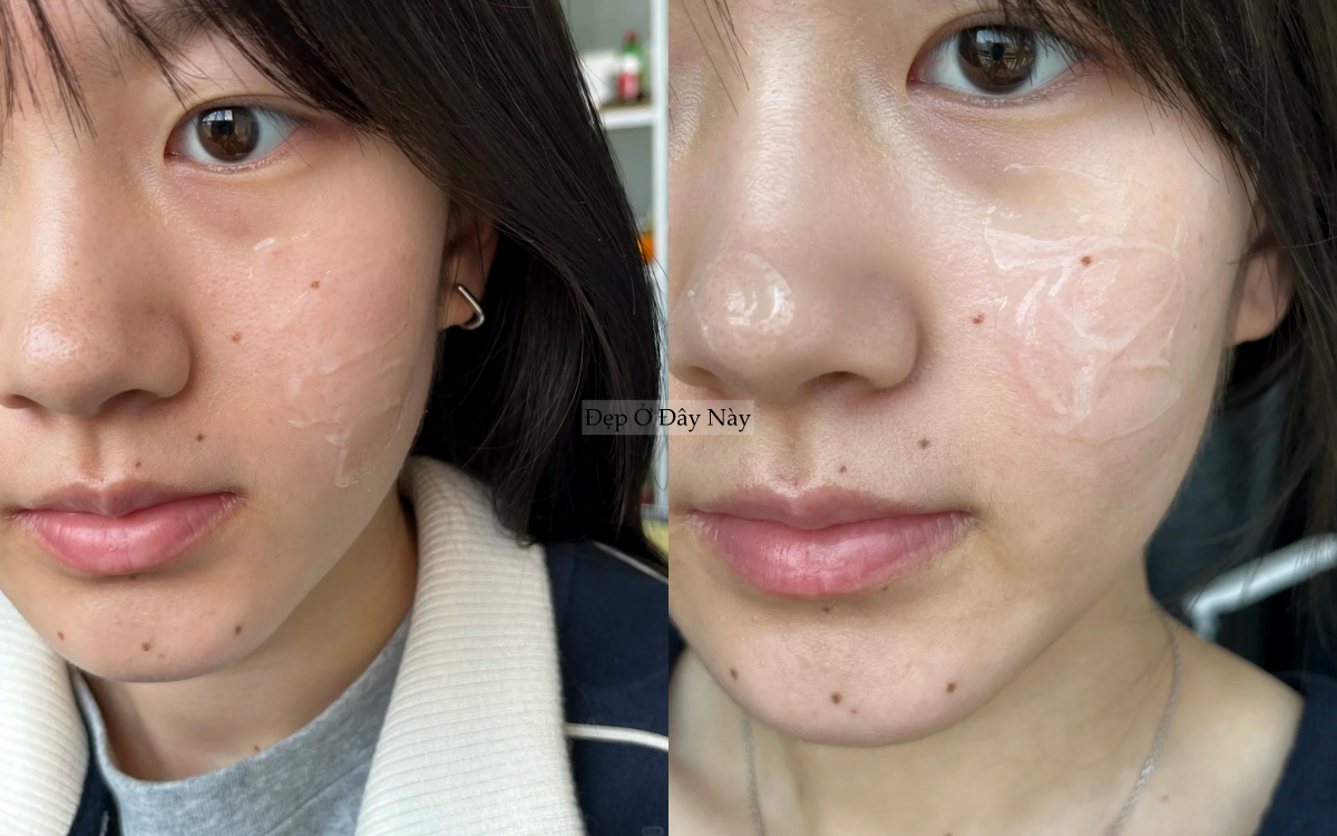 Kh&ocirc;ng d&ugrave;ng mỹ phẩm đắt tiền, blogger 25 tuổi vẫn thu nhỏ lỗ ch&acirc;n l&ocirc;ng thấy r&otilde; - Ảnh 5.