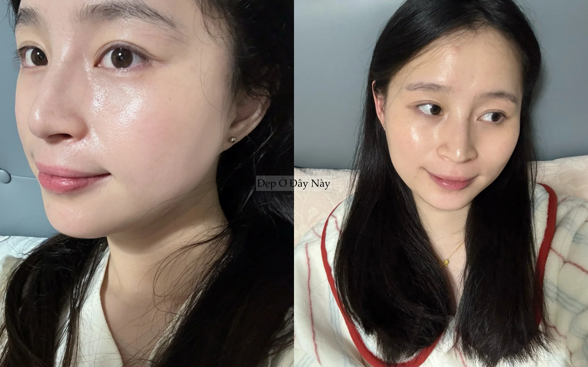 T&ocirc;i đ&atilde; c&oacute; l&agrave;n da căng b&oacute;ng như đi spa chỉ sau khi th&ecirc;m đ&uacute;ng 1 bước serum n&agrave;y - Ảnh 2.